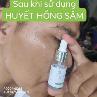 Huyết Hồng Sâmtrị mụn