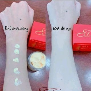 Kích siêu trắng gấp 5 lần ST