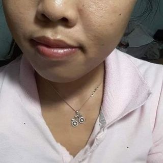 kem trị mụn nám tàng nhang hết dứt điểm