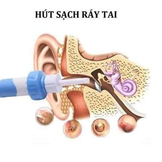 Máy hút ráy tai Nhật Bản