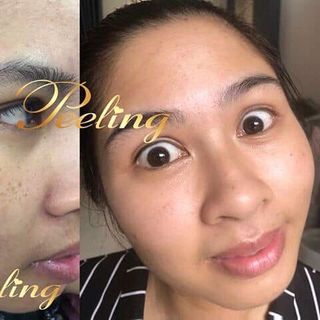 Kem Đặc Trị Tái Tạo Da Peeling WHITENING CREAM
