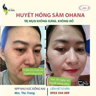 Huyết Hồng Sâm tái tạo mọi làn da giá sỉ