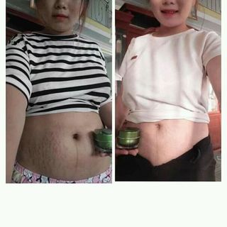 tri rạn da và các vấn đề về dakhông khỏi hoàn tiền