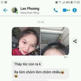 dầu gội