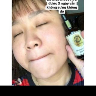 Tinh Chất Tái Tạo Trị Mụn Nám Sẹo Rỗ