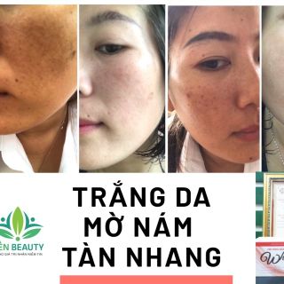 VIÊN UỐNG TRẮNG DA MỜ NÁM WHITE PLUS YẾN BEAUTY - CHỐNG NẮNG NỘI SINH