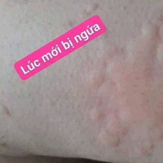 MỠ TRĂN NSTORE DƯỠNG DA BẢO VỆ SỨC KHOẺ