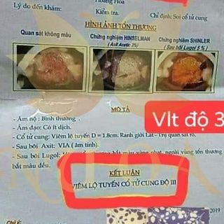 Phụ khoa Nữ Oa bí quyết giúp bạn khỏi viêm lộ tuyến