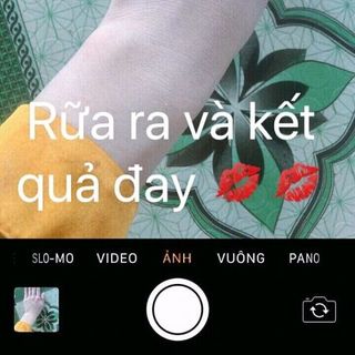 Ủ cấy trắng x6