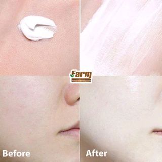 Combo dưỡng da tinh chất tổ yến SNP 5 món