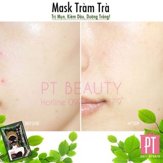 Mặt Nạ Trà Tràm sexylook