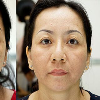 Tinh Chất Trị Nám Cao Cấp DewDew Luxury Cell Collagen Peptide 30ml