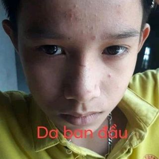 Da đẹp đón tết cùng Huyết Hồng Sâm