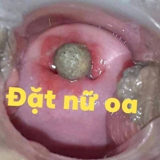 Cách đặt viên đặt Phụ khoa Nữ Oa