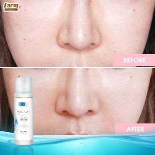 Dung dịch dưỡng ẩm cho da dầu Hadalabo Advanced Nourish