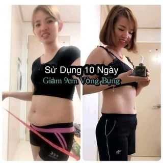 KEM TAN MỠ TRỊ RẠN DA