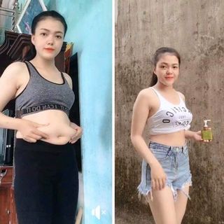 KEM TAN MỠ TRỊ RẠN DA