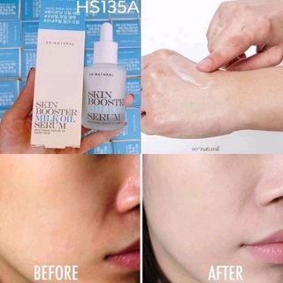 Serum kích trắng