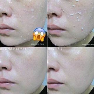 Tẩy tế bào chết arahan