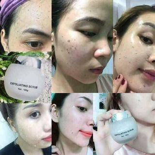 GEL TẨY TẾ BÀO CHẾT FACE S2B
