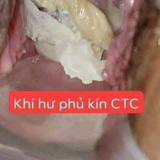 phụ khoa Nữ OaĐông dược Vũ Đức