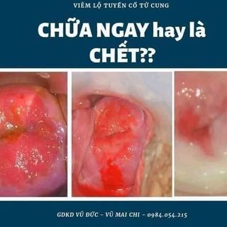 phụ khoa Nữ OaĐông dược Vũ Đức