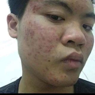 Huyết Hồng Sâmohana bí quyết để có làn da đẹp