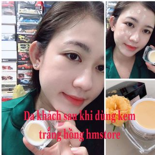 Kem trắng hồng căn bóng HMSTORE