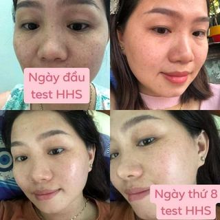 Đi học để chăm sóc da cho bản thân và các chị eHuyết Hồng Sâm