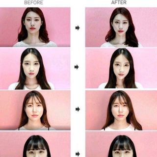 Miếng dán tạo mặt V-line giá sỉ​ giá bán buôn