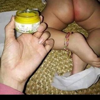 KEM DƯỠNG DA THẢO MỘC TRẦN KIM HUYỀN