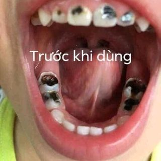 đặc trị răng miệng trần kim huyền