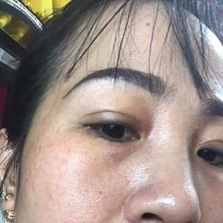 mỹ phẩm quin - kem nám quin