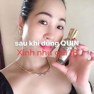 mỹ phẩm quin - kem nám quin