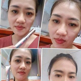 kem trị thâm mắt hanco doctor eye