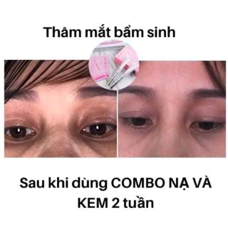 kem trị thâm mắt hanco việt nam