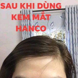 kem trị thâm mắt hanco