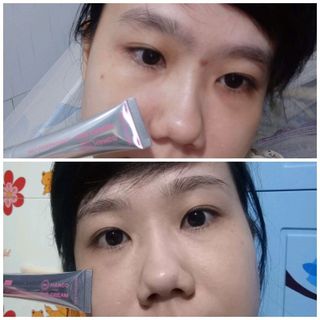 kem trị thâm mắt doctor eye