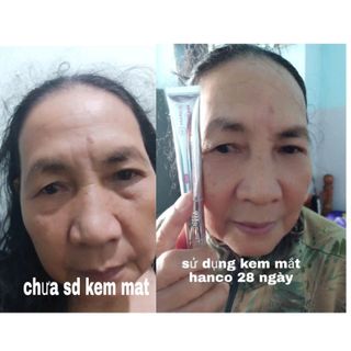 kem trị thâm mắt doctor eye
