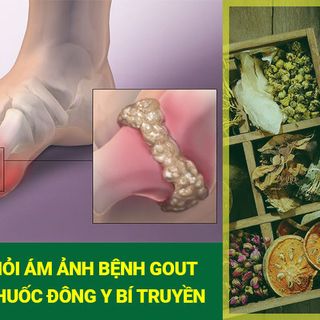 Trà thảo mộc trị bệnh gút trị viêm đa khớp Trần Kim Huyền