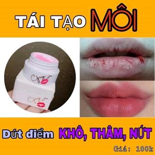 Ủ môi Hàn Quốc