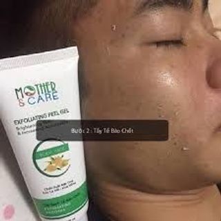 Tẩy da chết mother care