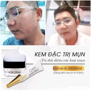 kem mụn Queenie skin giá sỉ