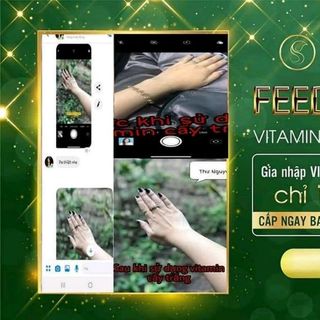 Vitamin Cấy Trắng SATHI