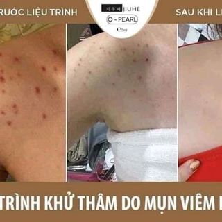 Jiuhe Hàn Quốc