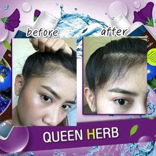 BỘ GỘI XẢ DETOX HAIR QUEEN HEART THÁI ĐANG HOT ONLINE