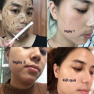 Bộ đôi dưỡng da Peed da vi tảo biển Tế bài gốc mỡ người Bqcell Hàn quốc