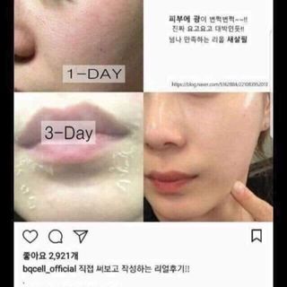 Bộ đôi dưỡng da Peed da vi tảo biển Tế bài gốc mỡ người Bqcell Hàn quốc