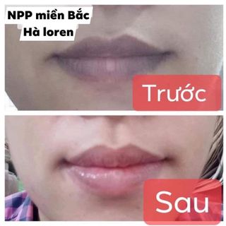 Kem Làm Hồng Môi XLIP 5ml Gcell Hàn quốc