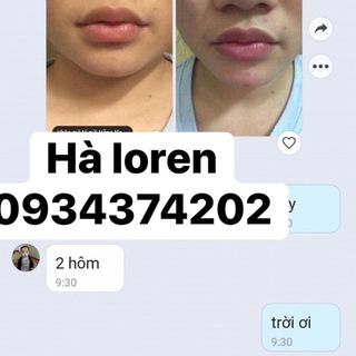 Kem Làm Hồng Môi XLIP 5ml Gcell Hàn quốc